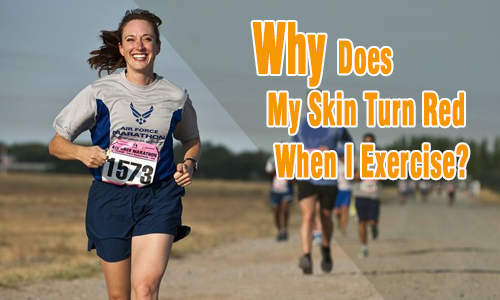 why-does-my-skin-turn-red-when-i-exercise